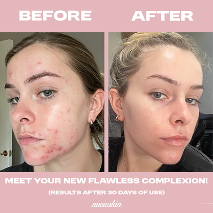 Dark Spot Correcting Serum