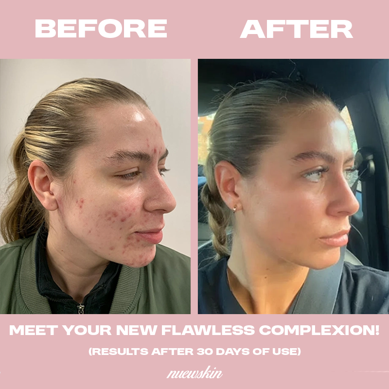 Dark Spot Correcting Serum